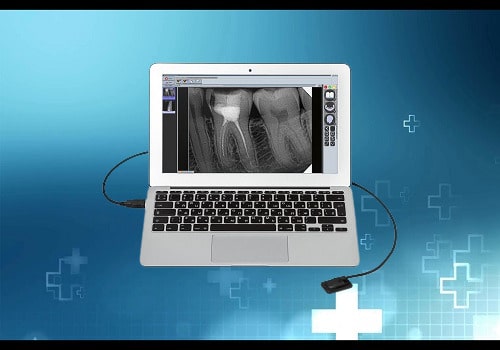 Ремонт визиографа